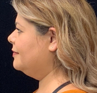 Side profile portrait of a woman with blonde hair wearing an orange top against a black background