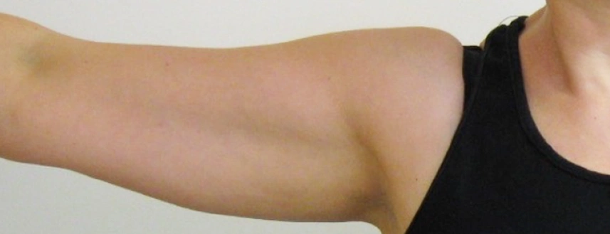 Close-up of a woman's outstretched upper arm and shoulder in black tank top against plain white background